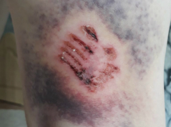 Агрессивные бродячие собаки покусали женщину в микрорайоне Донском Новочеркасска