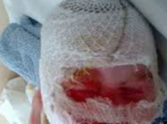 Недалеко от Новочеркасска  в поселке Казачьи Лагери маленькая девочка обварила себе лицо кипятком