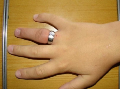 Для того, чтобы снять с пальца кольцо, жительнице Новочеркасска пришлось вызывать спасателей