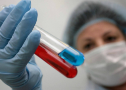 Новочеркасск занял пятое место в Ростовской области по количеству заболевших ВИЧ за год