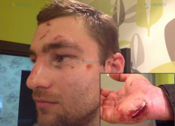 В Ростове неизвестные жестоко избили участника Олимпийских игр по академической гребле