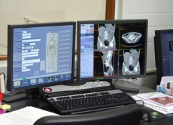 Новочеркасцам больше не придется ездить в Ростов для обследования на томографе