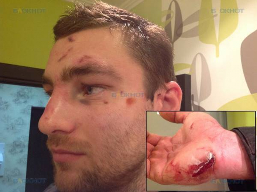 В Ростове неизвестные жестоко избили участника Олимпийских игр по академической гребле